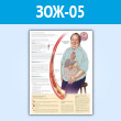 Плакат «Что такое метаболический синдром?» (ЗОЖ-05, пластик 2 мм, A1, 1 лист)